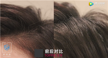 【浓密发量】30秒拯救发量！头发用的化妆品——TOPPIK顶丰增发纤维