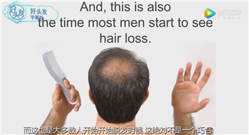 【国外专家聊脱发】低睾酮会导致脱发吗？