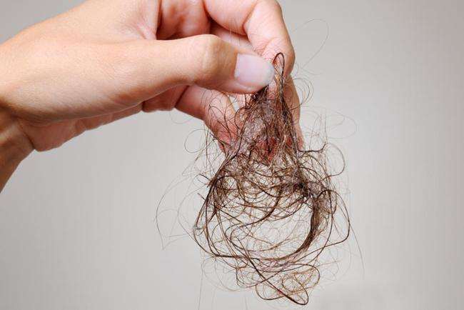女人脱发是怎么回事呢?如何改善脱发呢?头发种植效果好吗?