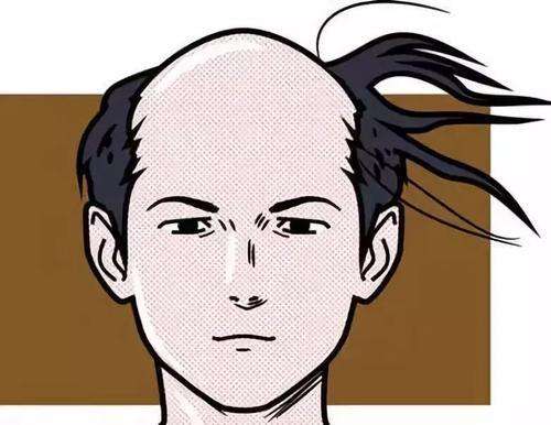 为何年轻男性会脱发，多半是这3个原因在作祟，赶紧来看看